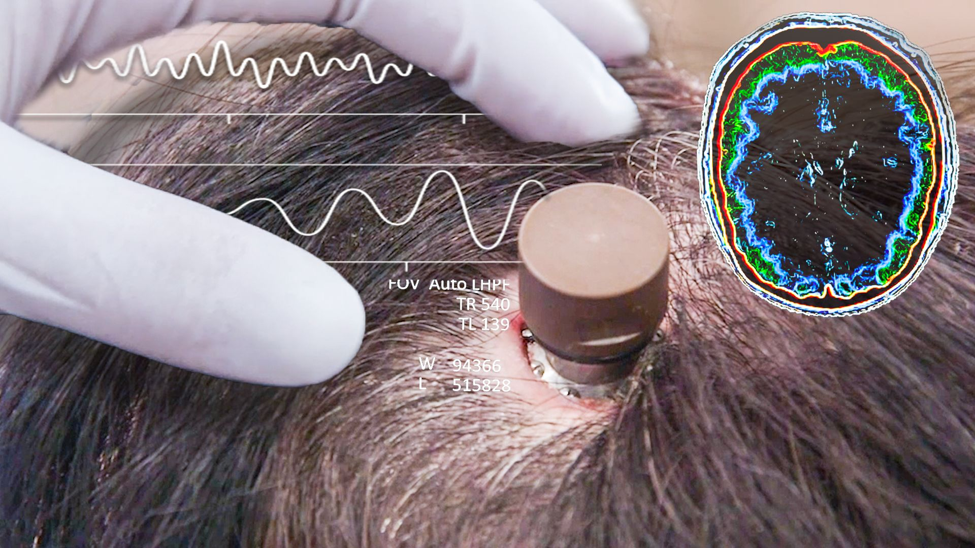 AI's next bottleneck isn't the model. It's your brain.